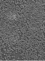 PVDF separator surface microscopy example with densely distributed fine particles
